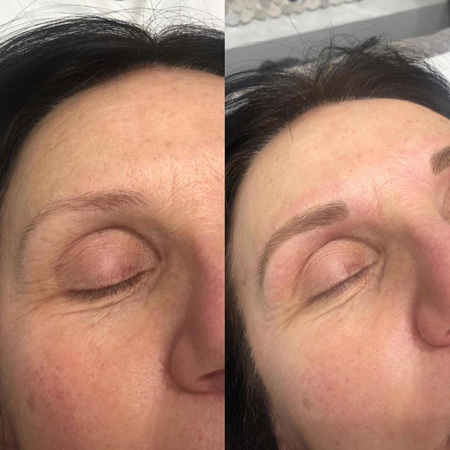 Creations Beauty Eyebrows Before and After